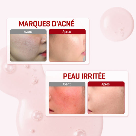 SNAIL TRUECICA MIRACLE REPAIR SERUM 50ML