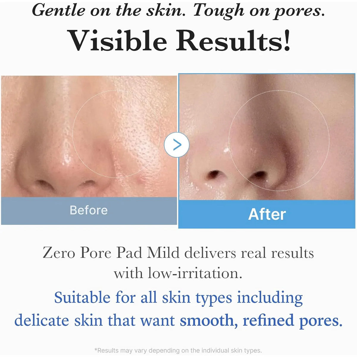 MEDICUBE ZERO PORE PAD MILD 70PADS 155G