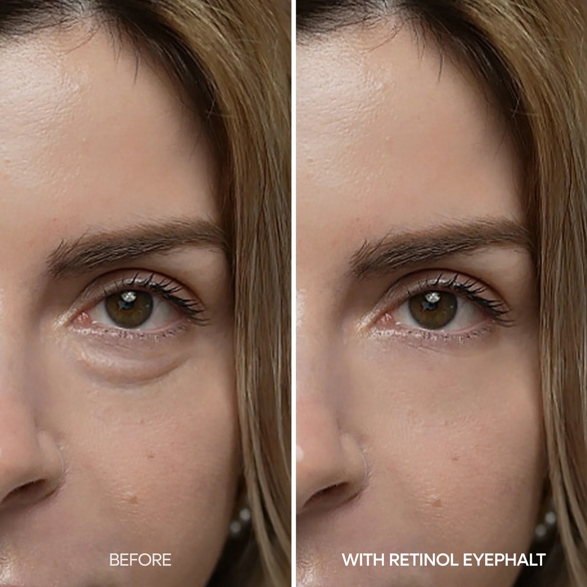 DR.MELAXIN EYEPHALT RETINOL EYEBAG CREAM 10G