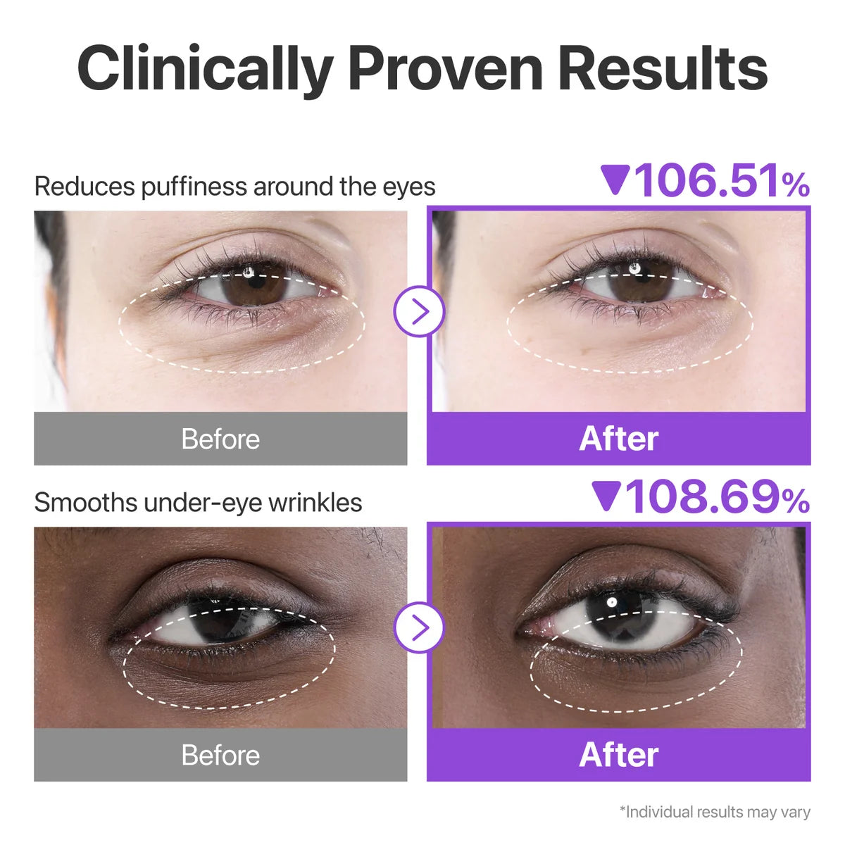 NUMBUZIN NO.9 NAD+ COLLAGEN UNDER EYE PATCHES 5 PAIRS