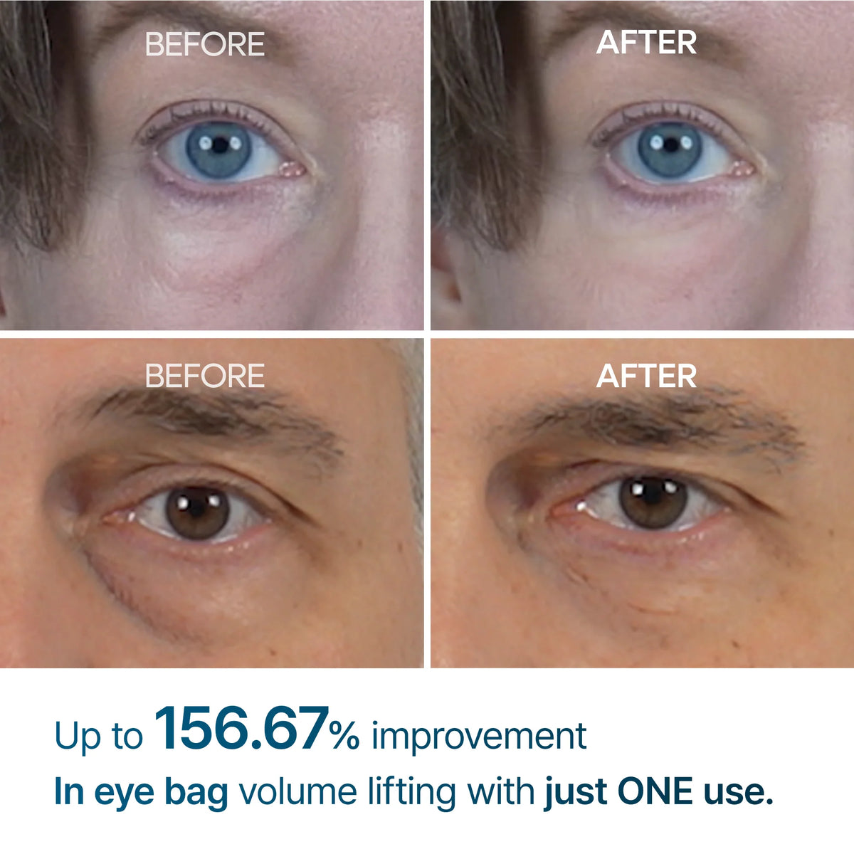 DR.MELAXIN EYEPHALT EYEBAG CREAM 10G