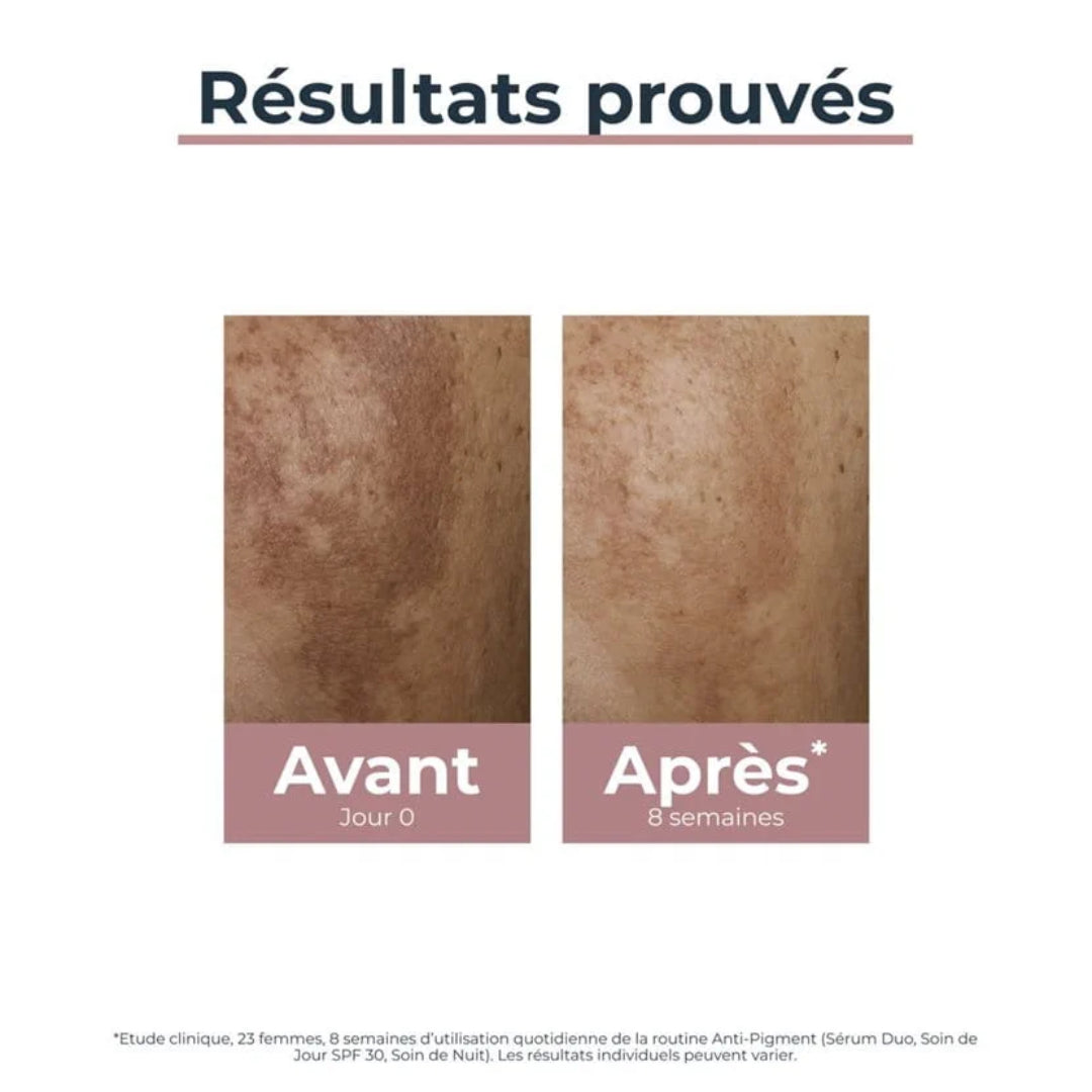 Eucerin ANTI-PIGMENT Sérum Duo - 30ml