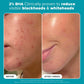 PAULA'S CHOICE - Le Kit Exfoliants AHA + BHA